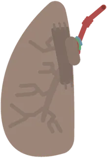 Extra Lung